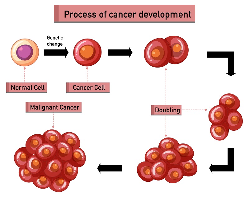 Staging | Breast Cancer Treatment in Pune | Dr. Sumit Shah
