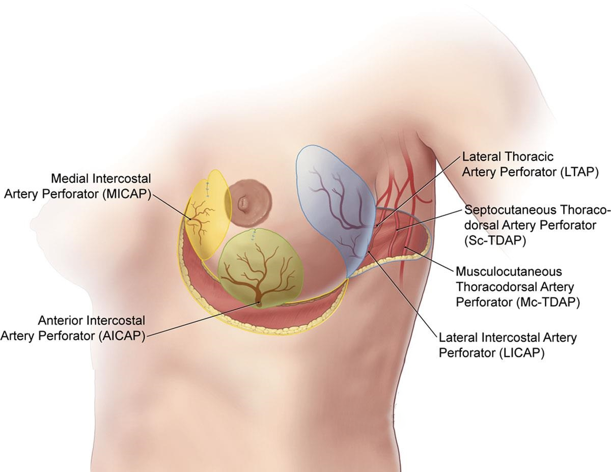 Oncoplastic Breast Surgery in Pune | Cancer Surgeon In Pune | Dr. Sumit Shah Oncoplastic Breast Surgery in Pune | Cancer Surgeon In Pune | Dr. Sumit Shah